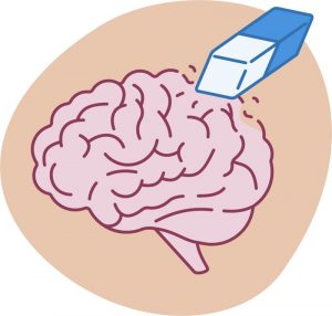 Image of brain to represent brain fog and memory loss