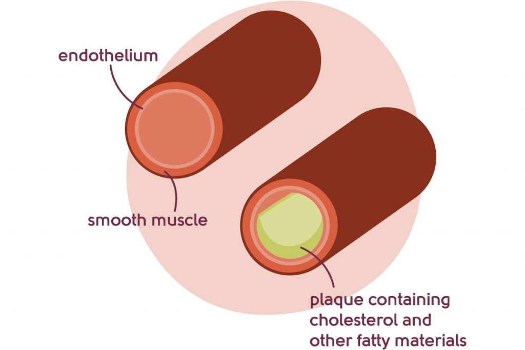 Arteries diagram