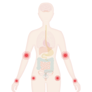 Image of the body with joints highlighted