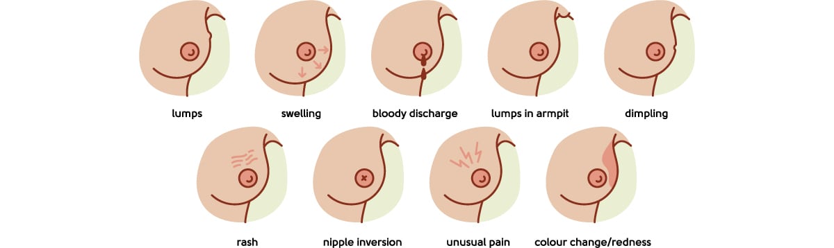 Menopause Symptoms, Breast Tenderness