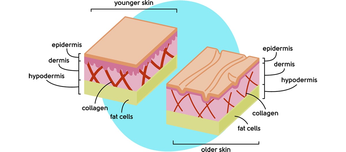 Menopause skin changes