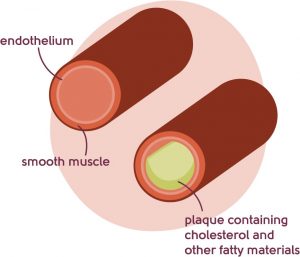 Image to show arteries